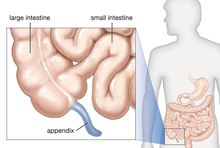 Appendix